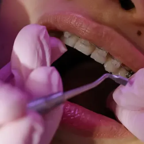 Ortodoncia Ortodoncia